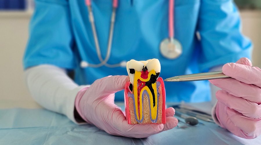 A dentist holding a root canal model